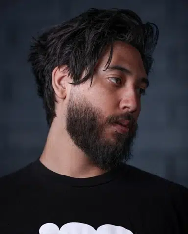 Thinning Hair