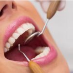 Teeth