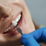 dental implants hungary helvetic clinics